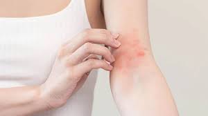 Δερματοπάθειες